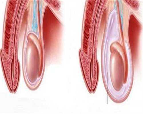 广州恩鼎试管_神州中泰代孕的价格,怀孕3胞胎减胎有什么影响？建议孕妇慎重考